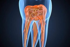 endodontia